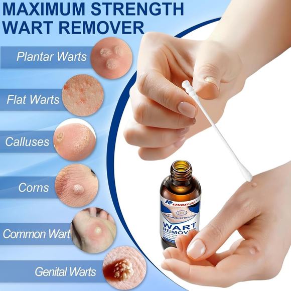 17% Salicylic Acid Liquid Wart Remover, Corn, Callus 1 floz, Fast Acting - Picture 3 of 4